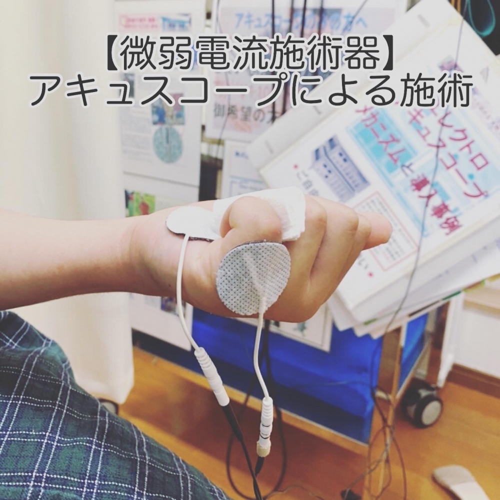 アキュ