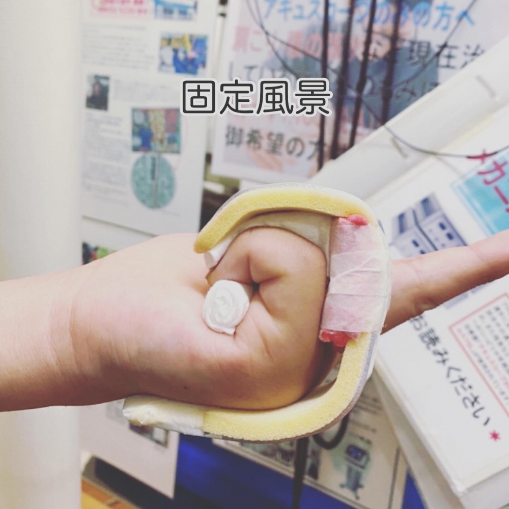 固定