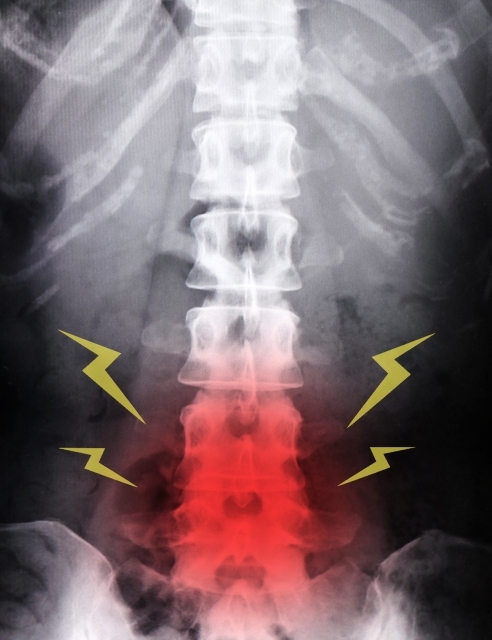 腰の怪我